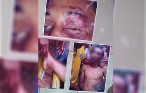 Korban Penganiayaan Polisi 2