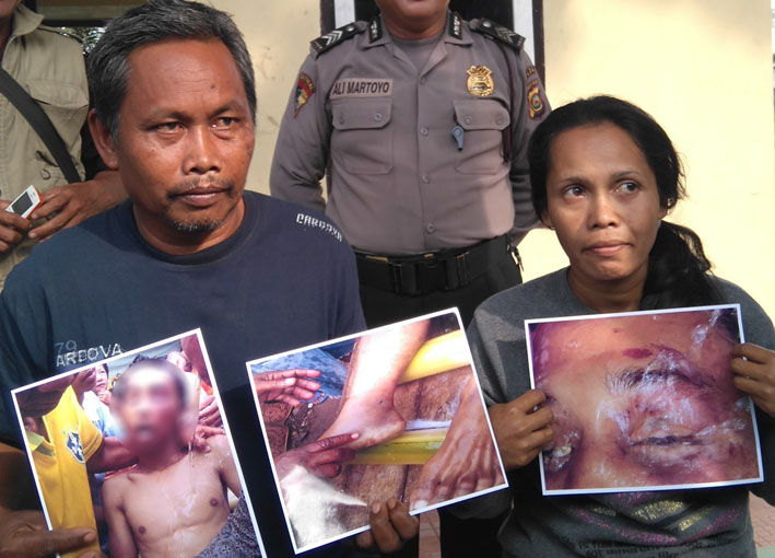 Korban Penganiayaan Polisi