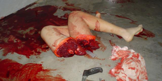 dismemberment_brasil_2