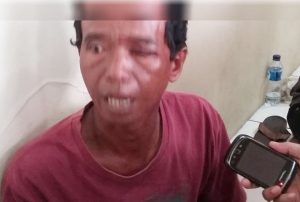 Tersangka Pencabulan