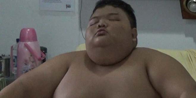RISKI BOCAH KELEBIHAN BERAT BADAN