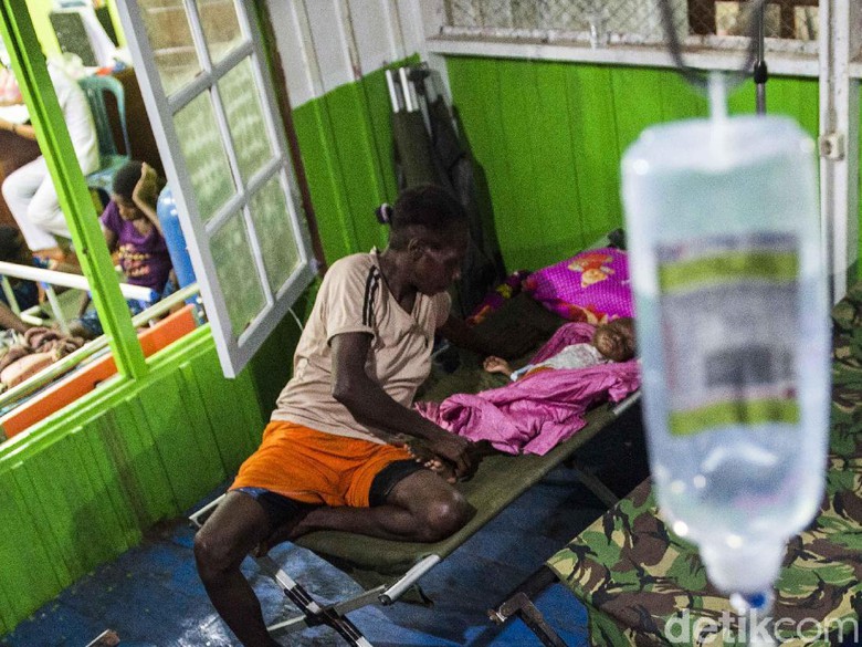 Pasien Gizi Buruk di Kabupaten Asmat