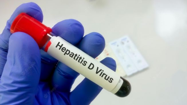 24773-penyakit-hepatitis-akut-ramai-diperbincangkan-karena-menyerang-anak-anak-di-beberapa-negara
