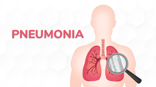 Pneomina