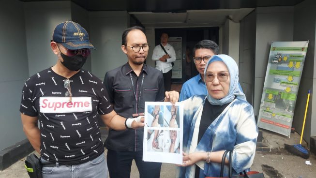 Titis Rachmawati SH MH CLA saat menunjukkan foto kondisi tangan kliennya yang mengalami pembusukan